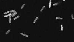 Batteri al microscopio
